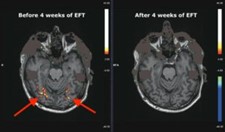 Functional Magnetic Resonance Imaging scans (fMRI)